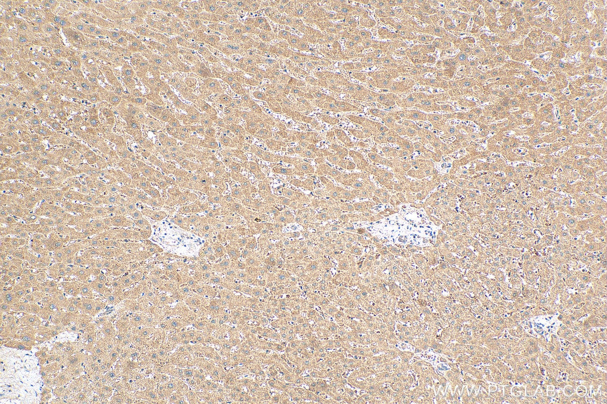 Immunohistochemistry (IHC) staining of human liver tissue using MITD1 Polyclonal antibody (17264-1-AP)