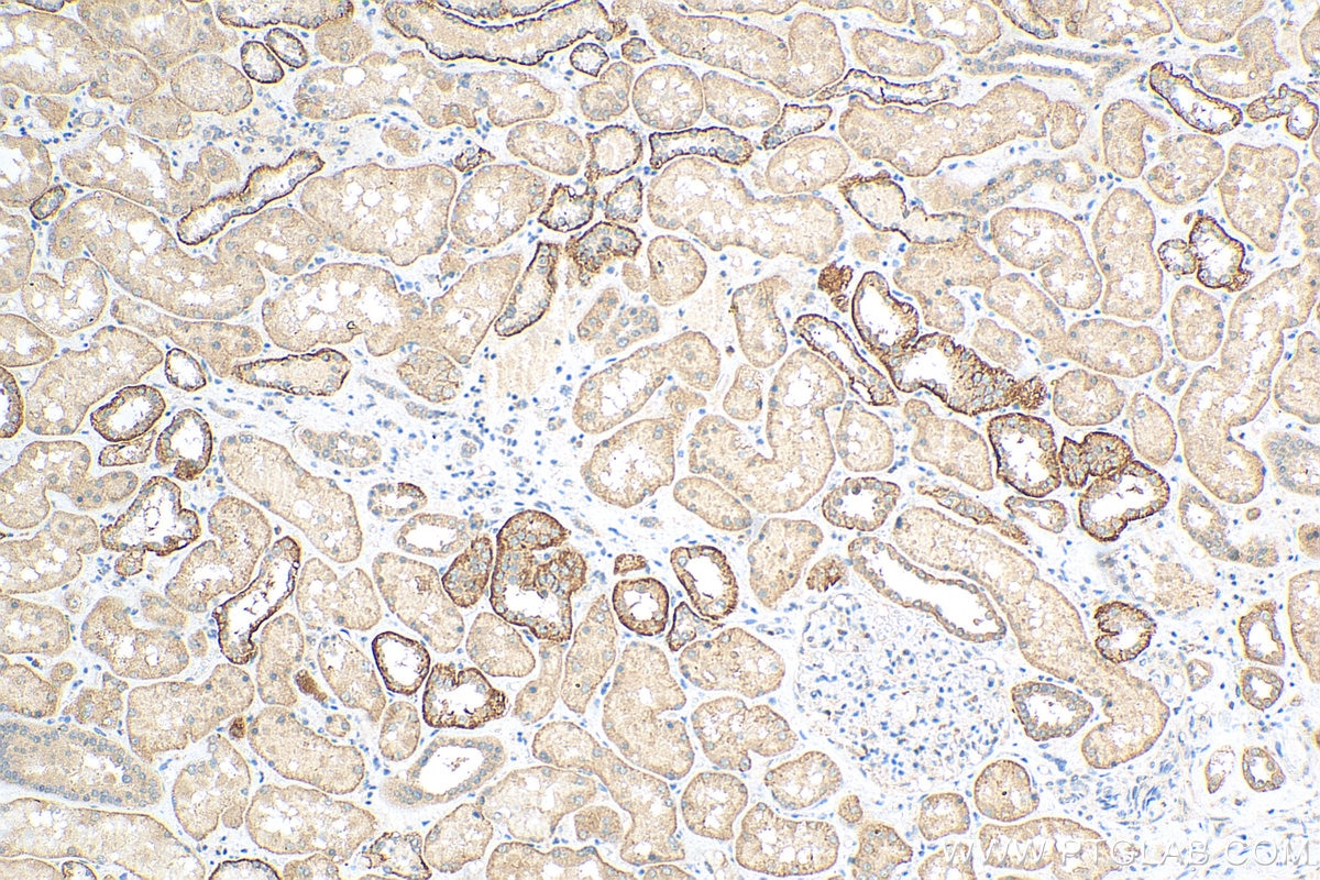 Immunohistochemistry (IHC) staining of human kidney tissue using MITD1 Polyclonal antibody (17264-1-AP)