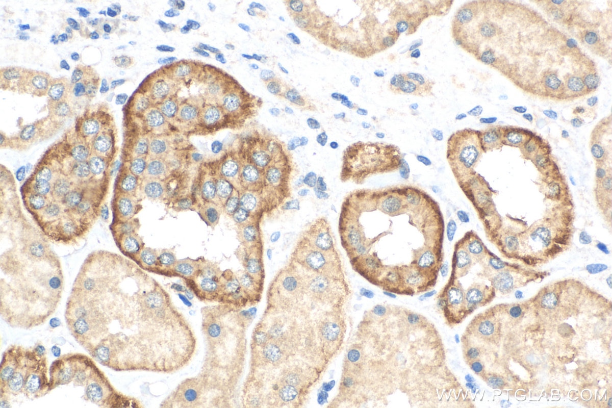 Immunohistochemistry (IHC) staining of human kidney tissue using MITD1 Polyclonal antibody (17264-1-AP)