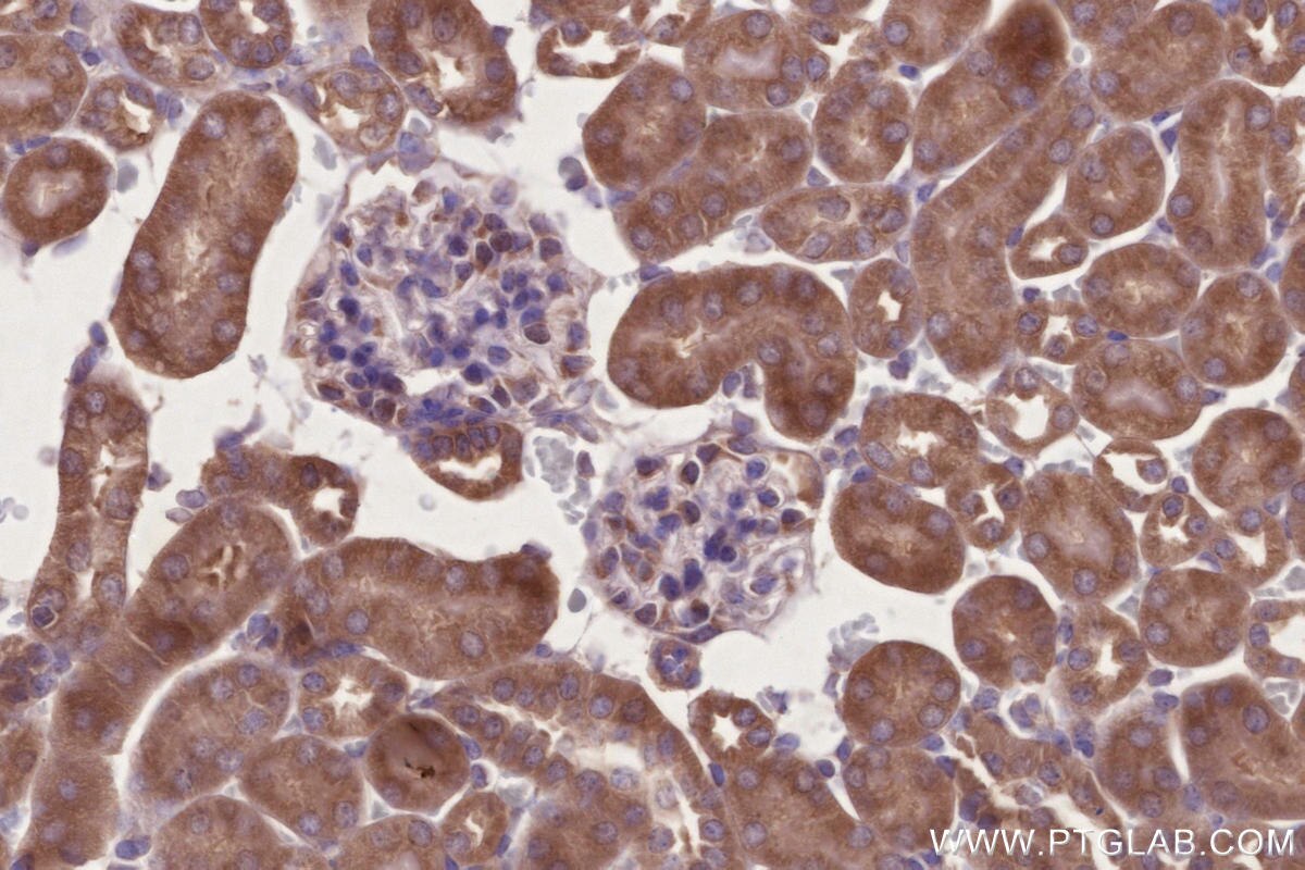 Immunohistochemistry (IHC) staining of mouse kidney tissue using MITD1 Polyclonal antibody (17264-1-AP)