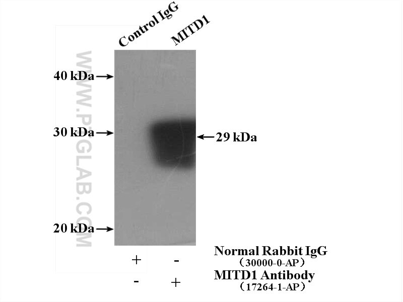 Immunoprecipitation (IP) experiment of HeLa cells using MITD1 Polyclonal antibody (17264-1-AP)