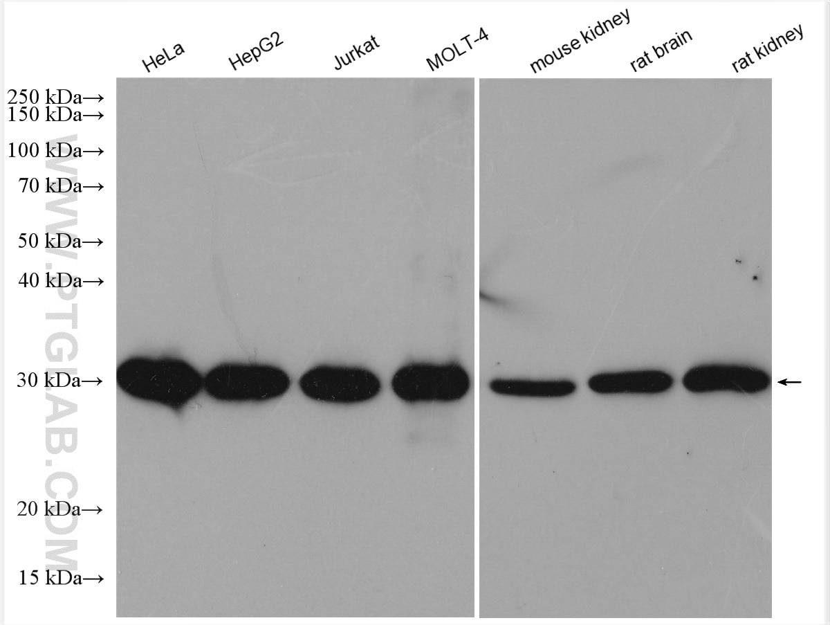 Western Blot (WB) analysis of various lysates using MITD1 Polyclonal antibody (17264-1-AP)