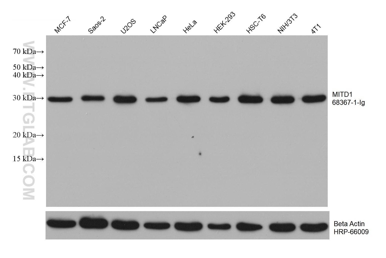 Western Blot (WB) analysis of various lysates using MITD1 Monoclonal antibody (68367-1-Ig)