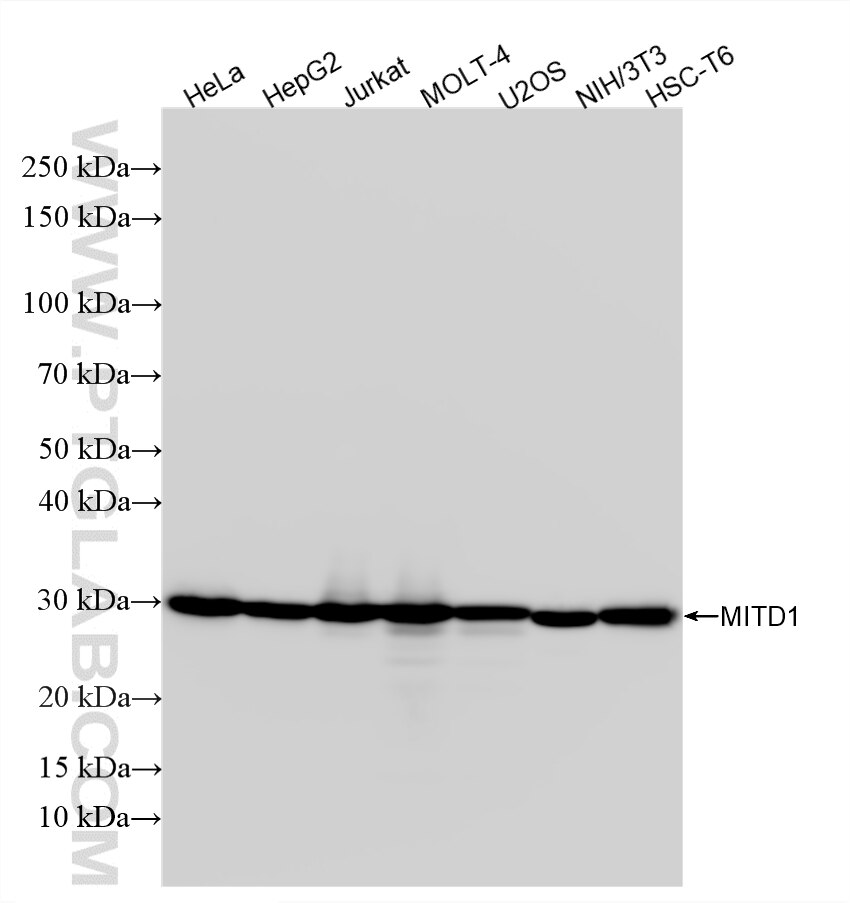 WB analysis using 88031-1-RR (same clone as 88031-1-PBS) Western Blot (WB) analysis of various lysates using MITD1 Recombinant monoclonal antibody (88031-1-RR)