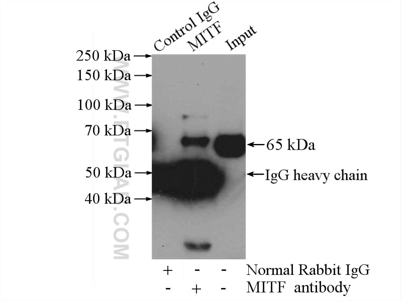 Immunoprecipitation (IP) experiment of mouse heart tissue using MITF Polyclonal antibody (13092-1-AP)