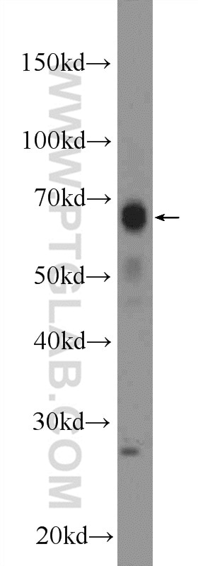 Western Blot (WB) analysis of rat skin tissue using MITF Polyclonal antibody (13092-1-AP)