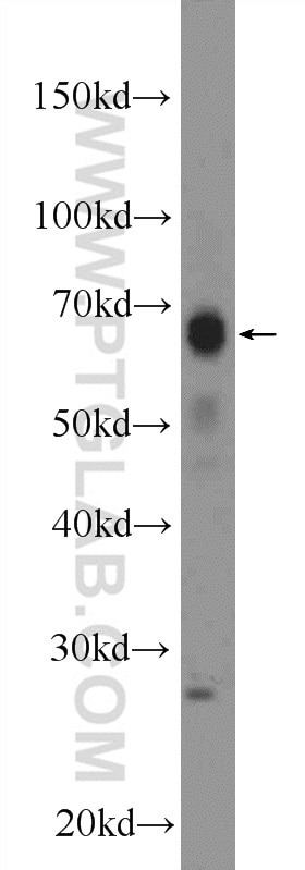 WB analysis of rat skin using 13092-1-AP