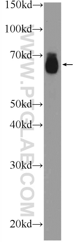 Western Blot (WB) analysis of mouse heart tissue using MITF Polyclonal antibody (13092-1-AP)