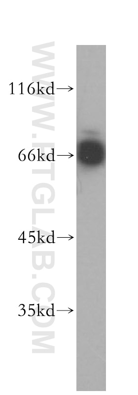 Western Blot (WB) analysis of Jurkat cells using MITF Polyclonal antibody (13092-1-AP)