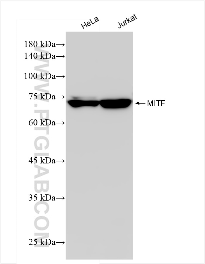 Western Blot (WB) analysis of various lysates using MITF Recombinant monoclonal antibody (83803-1-RR)