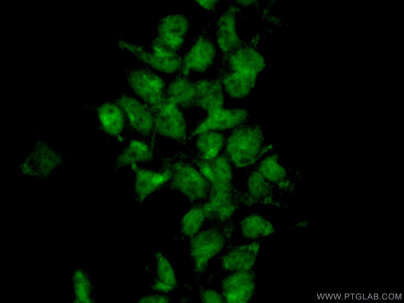 Immunofluorescence (IF) / fluorescent staining of HEK-293 cells using MIXL1 Polyclonal antibody (22772-1-AP)