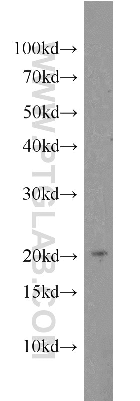 Western Blot (WB) analysis of HEK-293 cells using MIXL1 Polyclonal antibody (22772-1-AP)
