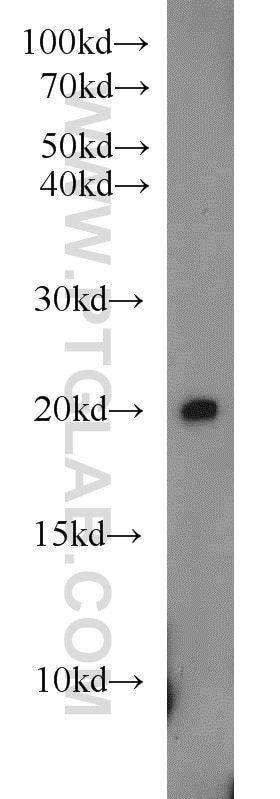 Western Blot (WB) analysis of rat pancreas tissue using MIXL1 Polyclonal antibody (22772-1-AP)