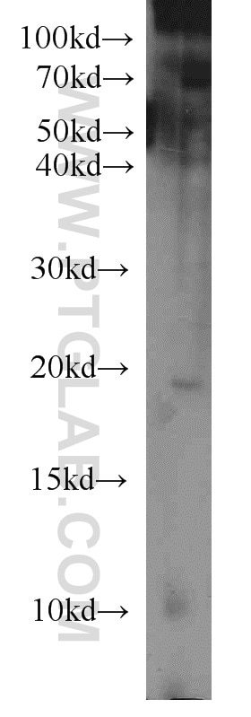 Western Blot (WB) analysis of H7ES cells using MIXL1 Polyclonal antibody (22772-1-AP)