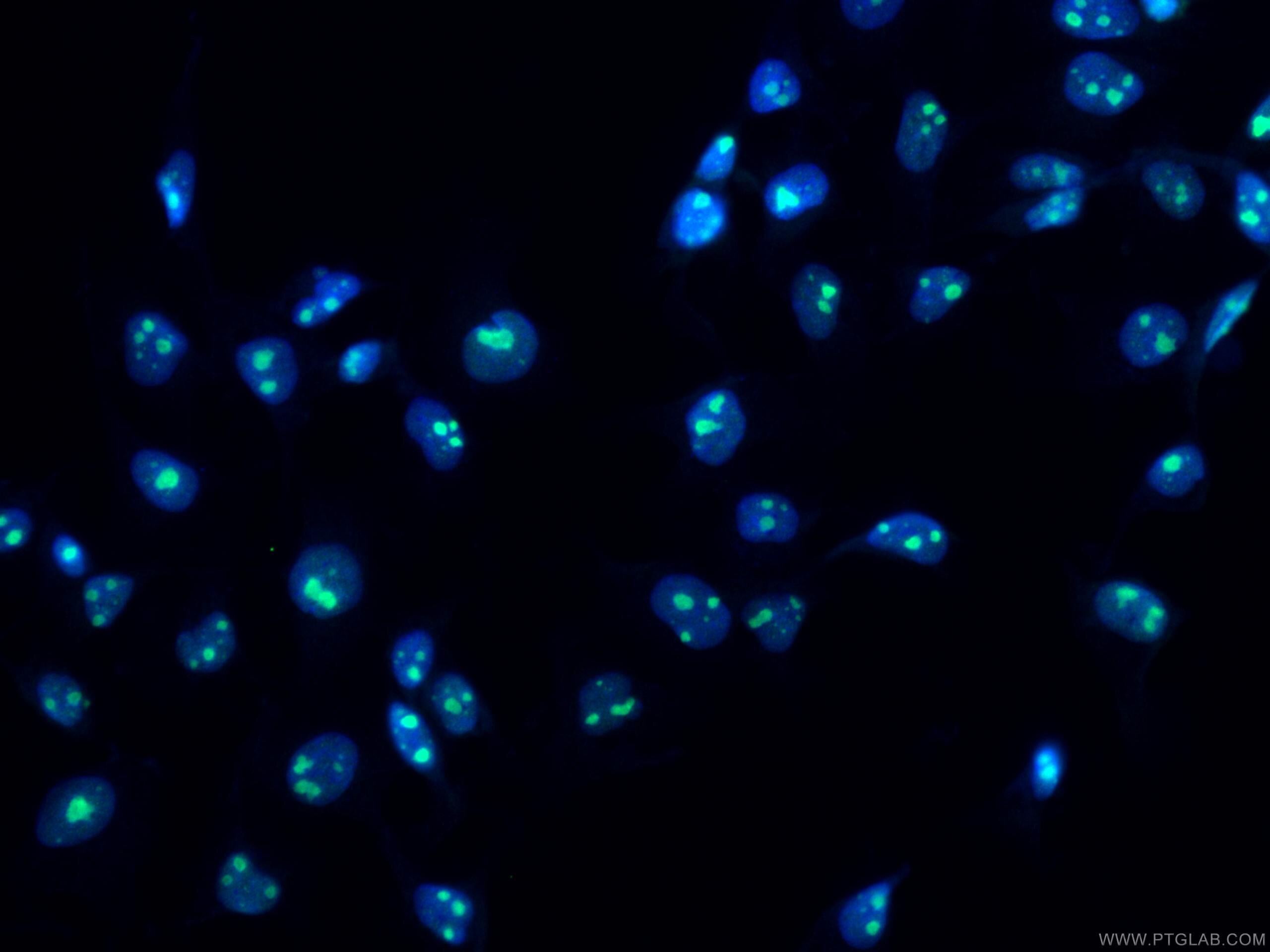 Immunofluorescence (IF) / fluorescent staining of MCF-7 cells using NIFK Polyclonal antibody (12615-1-AP)