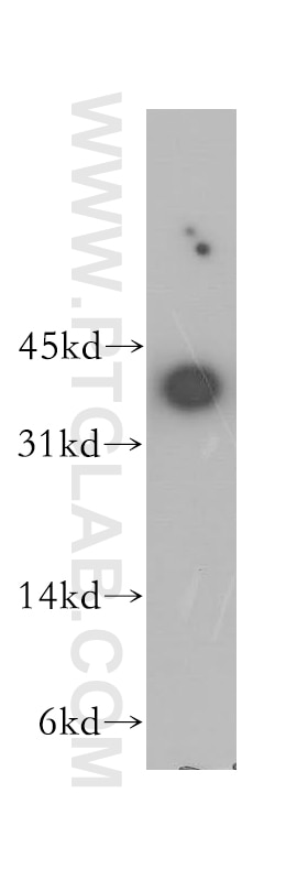 Western Blot (WB) analysis of HEK-293 cells using NIFK Polyclonal antibody (12615-1-AP)