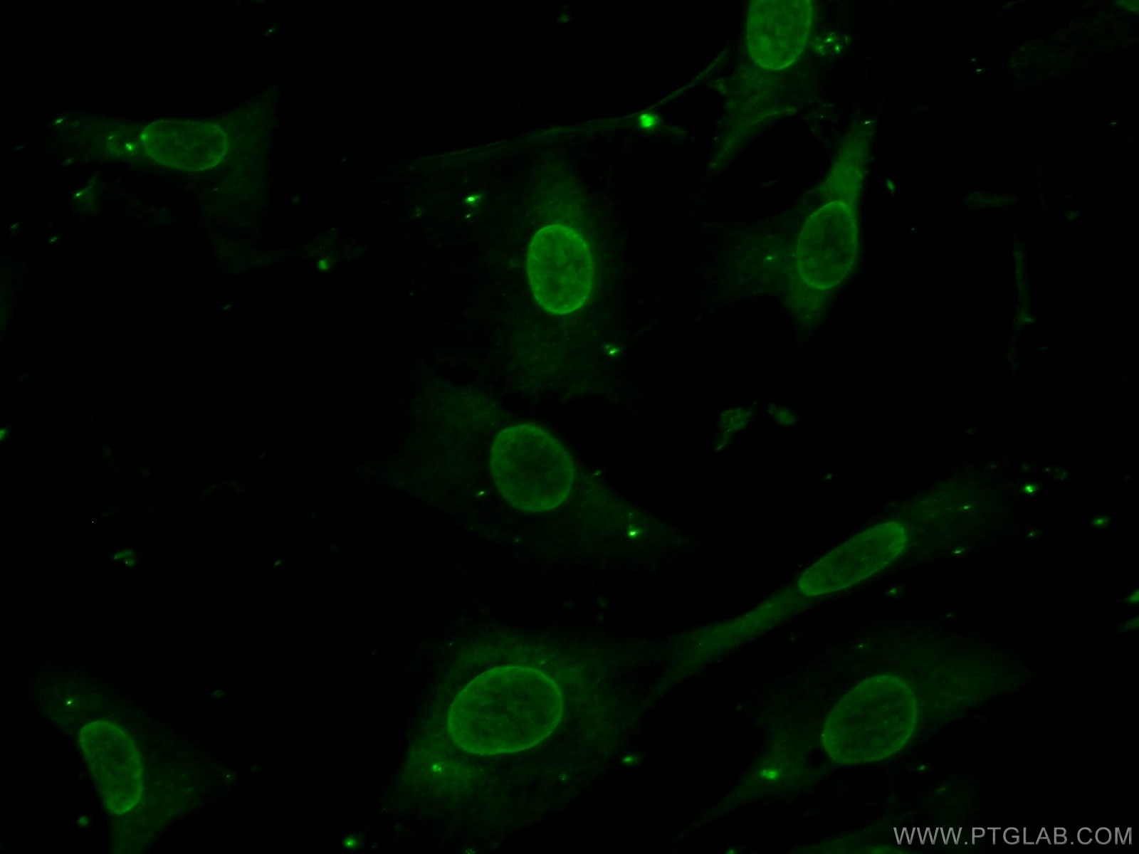 Immunofluorescence (IF) / fluorescent staining of NIH/3T3 cells using MKK7 Polyclonal antibody (55030-1-AP)