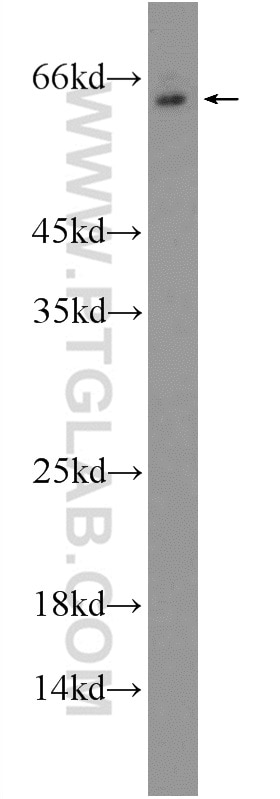 Western Blot (WB) analysis of NIH/3T3 cells using MKK7 Polyclonal antibody (55030-1-AP)