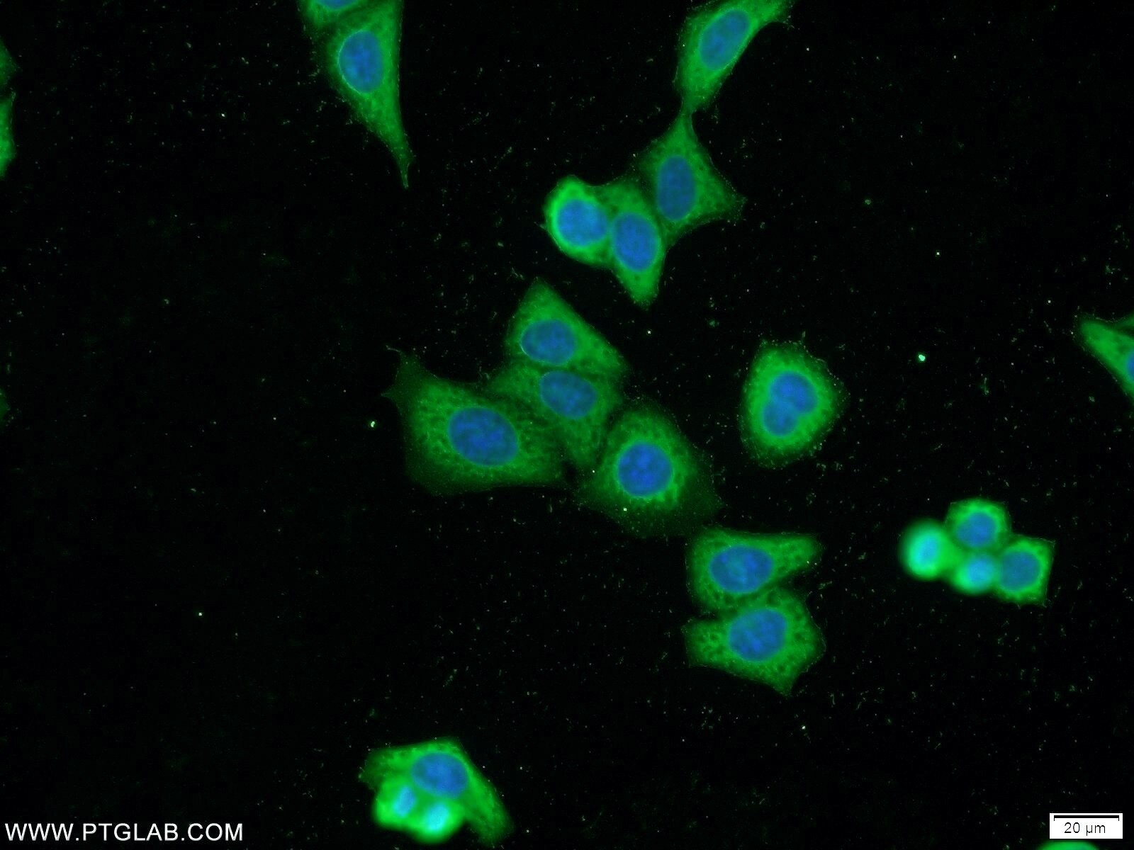 Immunofluorescence (IF) / fluorescent staining of HeLa cells using MKL1/MRTF-A Polyclonal antibody (21166-1-AP)