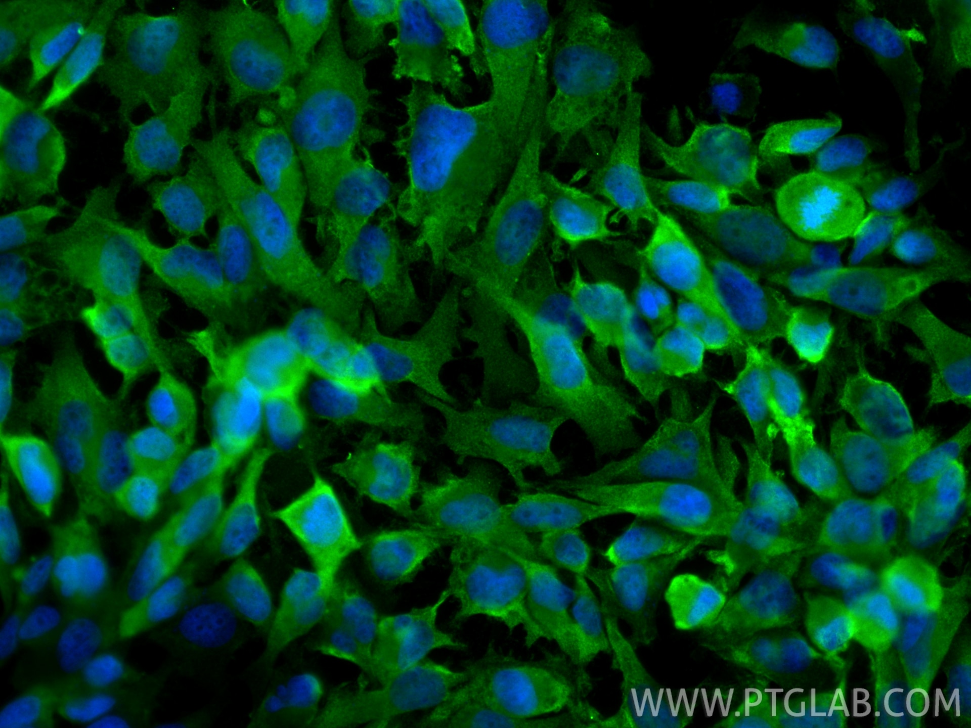 Immunofluorescent analysis of (4% PFA) fixed U-251 cells using MKL1/MRTF-A antibody (21166-1-AP) at dilution of 1:400 and CoraLite®488-Conjugated Goat Anti-Rabbit IgG(H+L) (SA00013-2). Immunofluorescence (IF) / fluorescent staining of U-251 cells using MKL1/MRTF-A Polyclonal antibody (21166-1-AP)