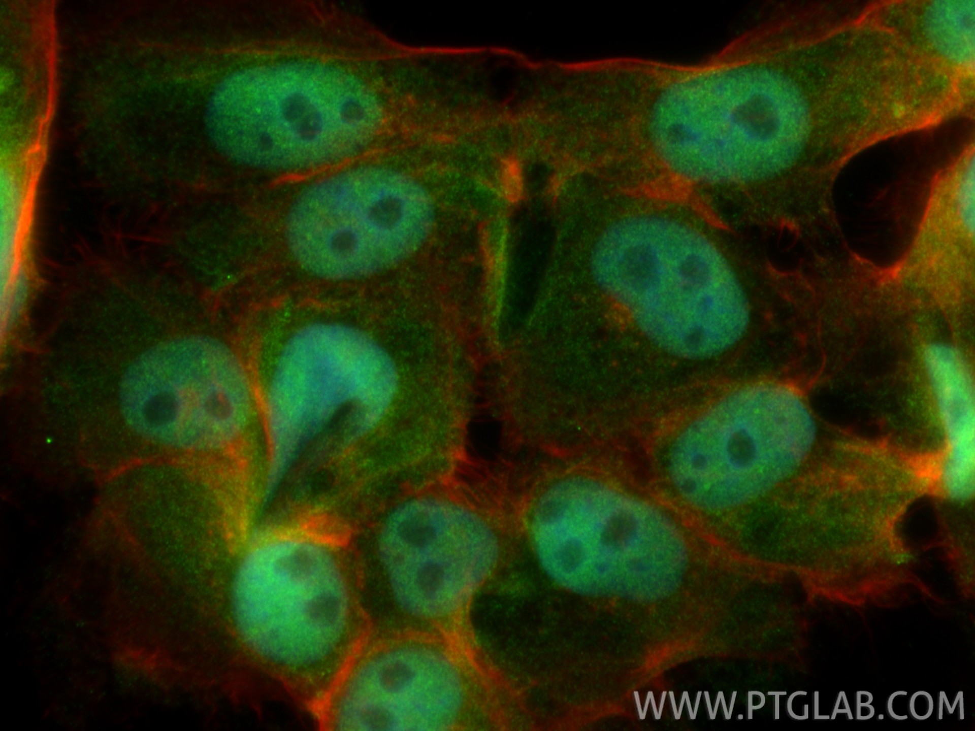 Immunofluorescence (IF) / fluorescent staining of U-251 cells using MKL1/MRTF-A Polyclonal antibody (21166-1-AP)