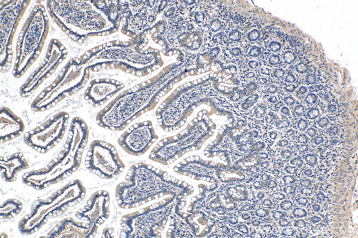Immunohistochemistry (IHC) staining of human small intestine tissue using MKL1 Polyclonal antibody (21166-1-AP)