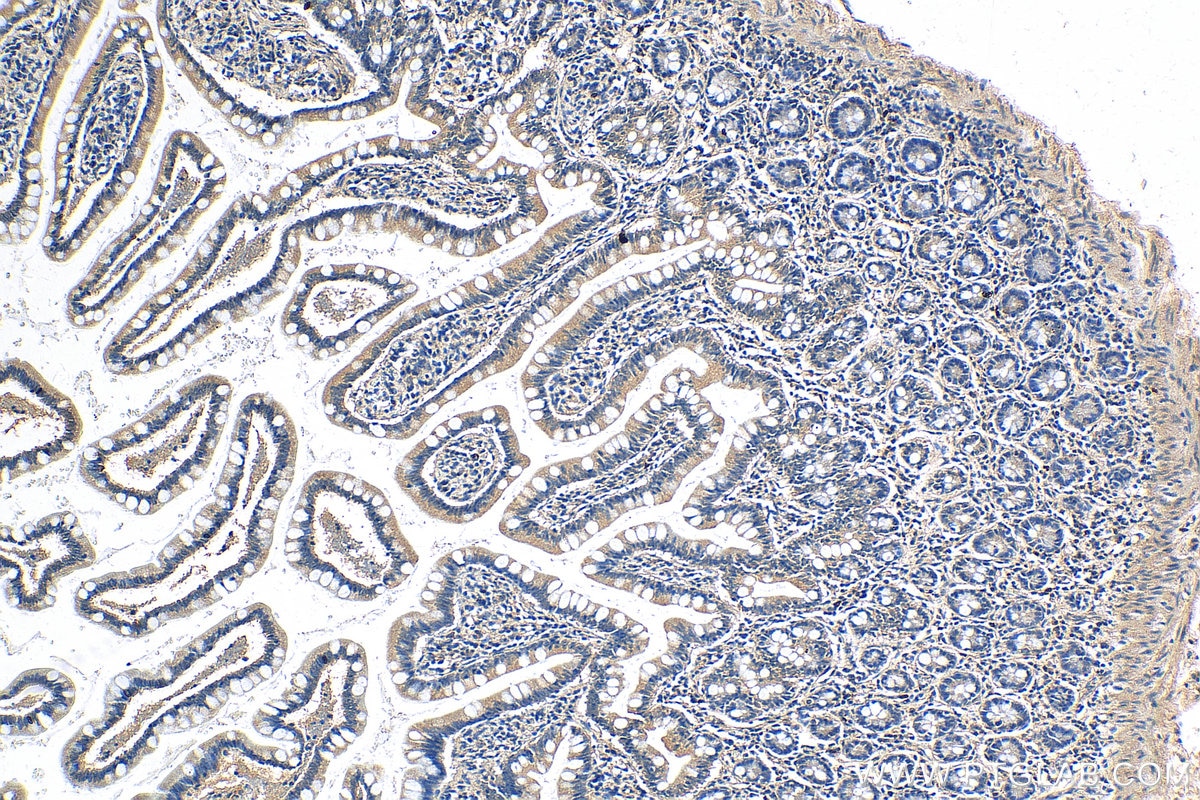 Immunohistochemistry (IHC) staining of human small intestine tissue using MKL1/MRTF-A Polyclonal antibody (21166-1-AP)