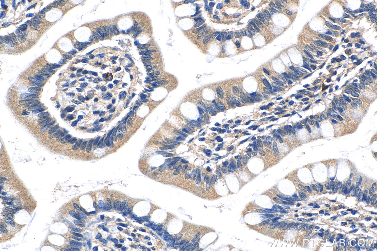Immunohistochemistry (IHC) staining of human small intestine tissue using MKL1/MRTF-A Polyclonal antibody (21166-1-AP)