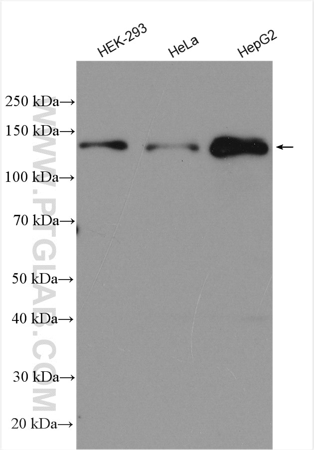 Western Blot (WB) analysis of various lysates using MKL1 Polyclonal antibody (21166-1-AP)