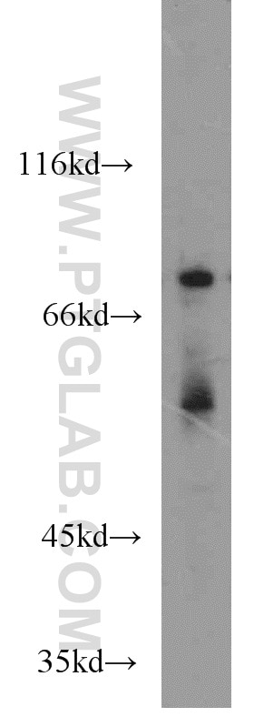 Western Blot (WB) analysis of Jurkat cells using Muskelin Polyclonal antibody (14735-1-AP)