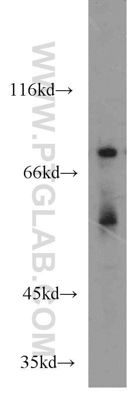 WB analysis of Jurkat using 14735-1-AP