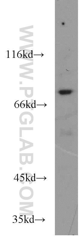 Western Blot (WB) analysis of Jurkat cells using Muskelin Polyclonal antibody (14735-1-AP)