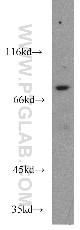 WB analysis of Jurkat using 14735-1-AP