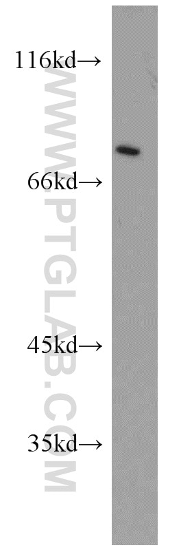 Western Blot (WB) analysis of Y79 cells using Muskelin Polyclonal antibody (14735-1-AP)