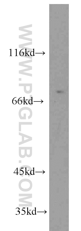 Western Blot (WB) analysis of Y79 cells using Muskelin Polyclonal antibody (14735-1-AP)