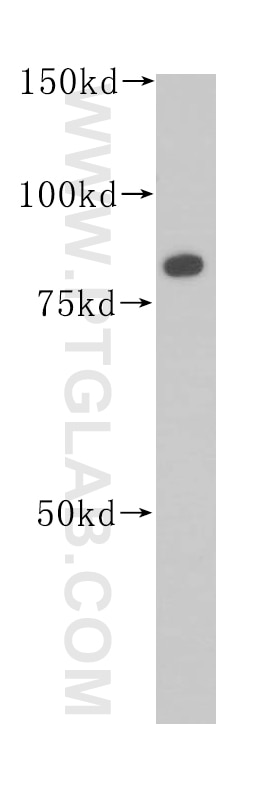 Western Blot (WB) analysis of Y79 cells using Muskelin Polyclonal antibody (14735-1-AP)