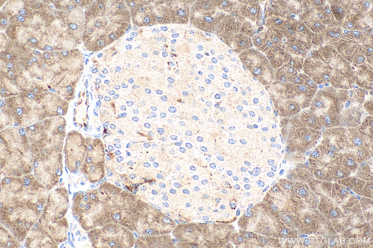 Immunohistochemistry (IHC) staining of mouse pancreas tissue using MNK1 Polyclonal antibody (10136-1-AP)