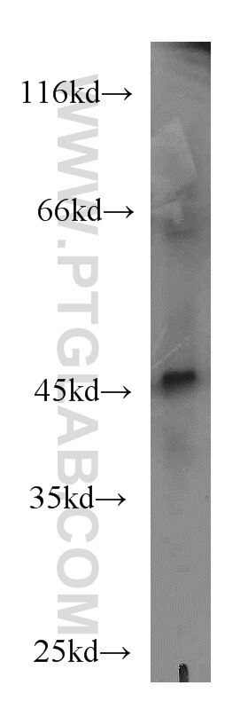 Western Blot (WB) analysis of mouse small intestine tissue using MNK1 Polyclonal antibody (10136-1-AP)