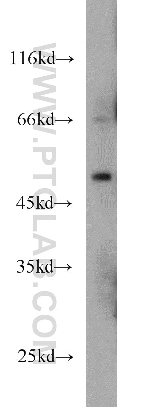Western Blot (WB) analysis of HeLa cells using MNK1 Polyclonal antibody (10136-1-AP)