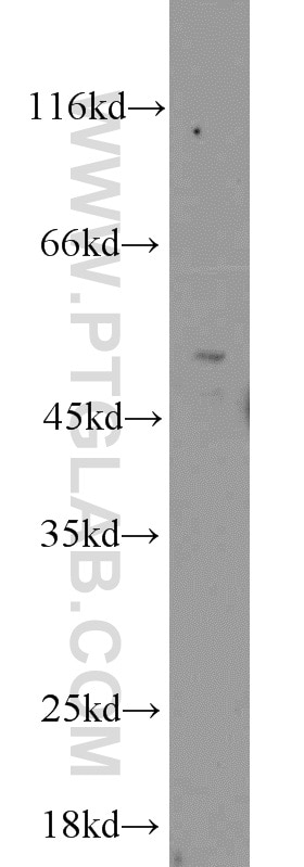 Western Blot (WB) analysis of HL-60 cells using MNK1 Polyclonal antibody (10136-1-AP)
