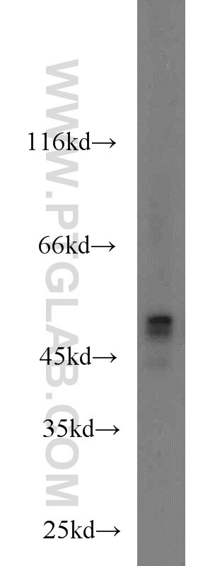 Western Blot (WB) analysis of HEK-293 cells using MNK1 Polyclonal antibody (10136-1-AP)