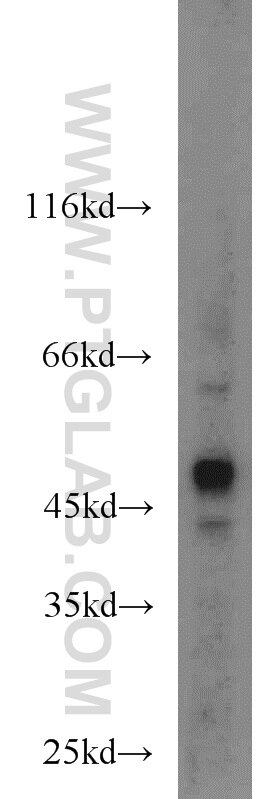 Western Blot (WB) analysis of HepG2 cells using MNK1 Polyclonal antibody (10136-1-AP)