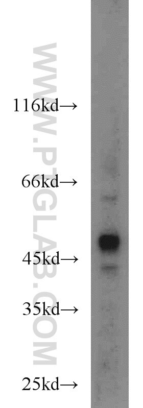 WB analysis of HepG2 using 10136-1-AP