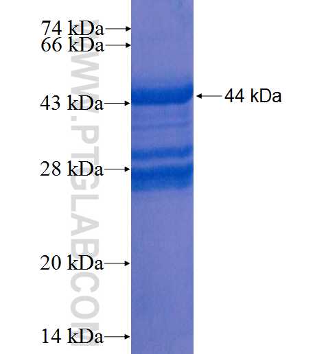 MKNK1 fusion protein Ag0184 SDS-PAGE