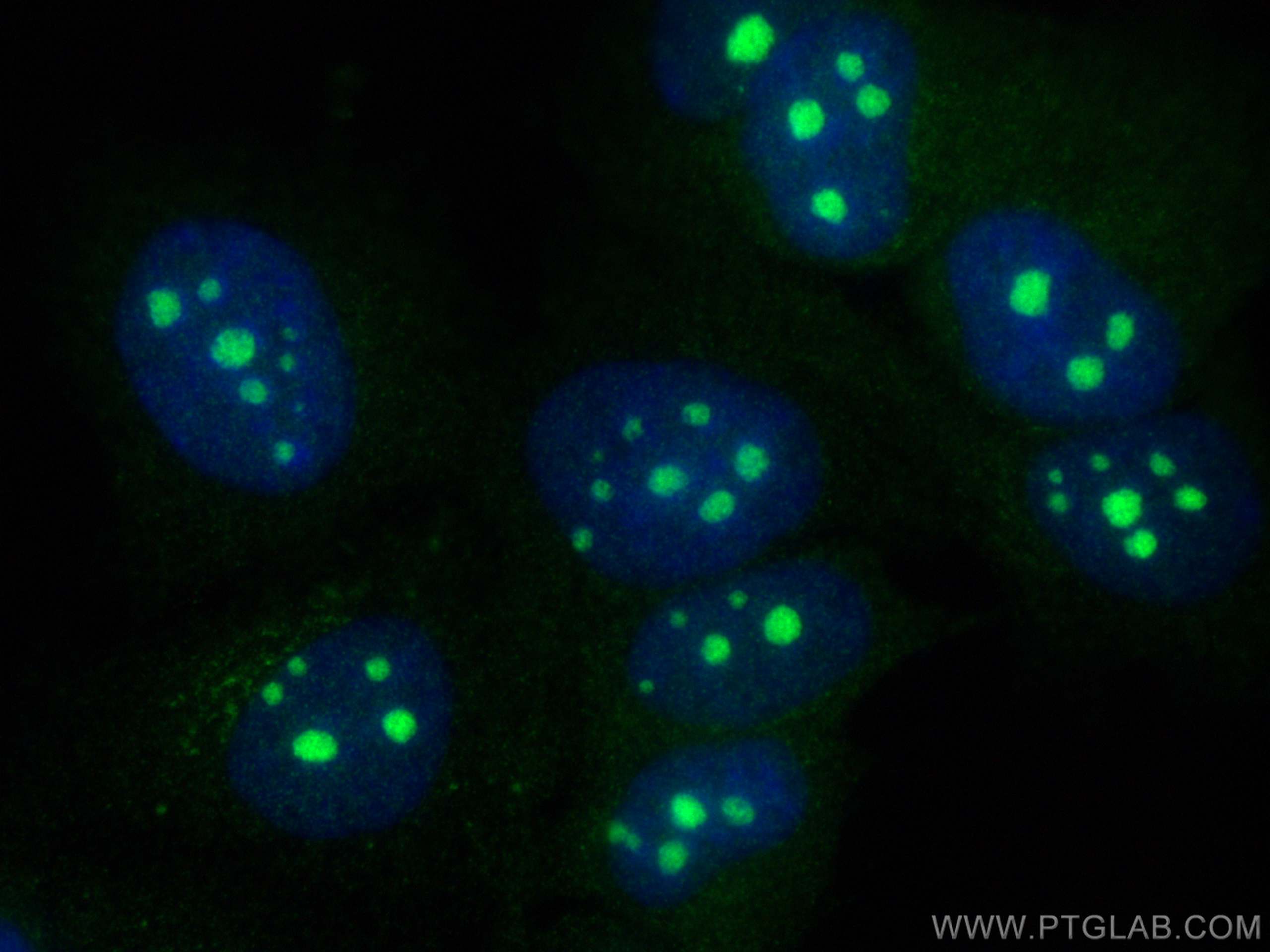 Immunofluorescence (IF) / fluorescent staining of MCF-7 cells using MKNK2 Polyclonal antibody (17354-1-AP)