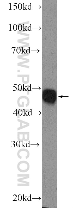 Western Blot (WB) analysis of mouse spleen tissue using MKNK2 Polyclonal antibody (17354-1-AP)