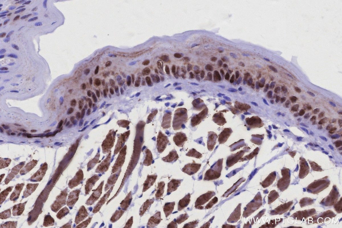 Immunohistochemistry (IHC) staining of mouse tongue tissue using MKNK2 Recombinant monoclonal antibody (83235-1-RR)