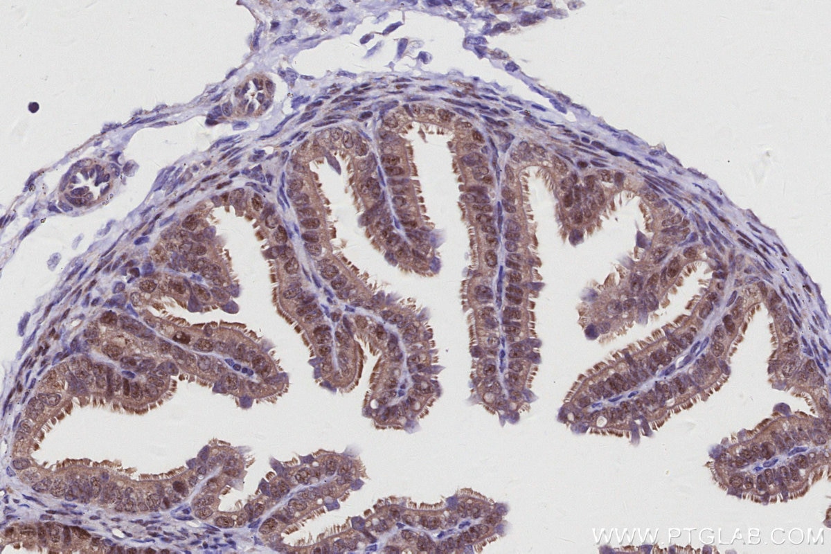 Immunohistochemistry (IHC) staining of mouse ovary tissue using MKNK2 Recombinant monoclonal antibody (83235-1-RR)