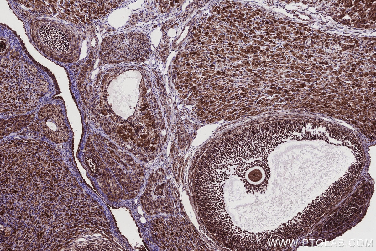 Immunohistochemistry (IHC) staining of rat ovary tissue using MKNK2 Recombinant monoclonal antibody (83235-1-RR)