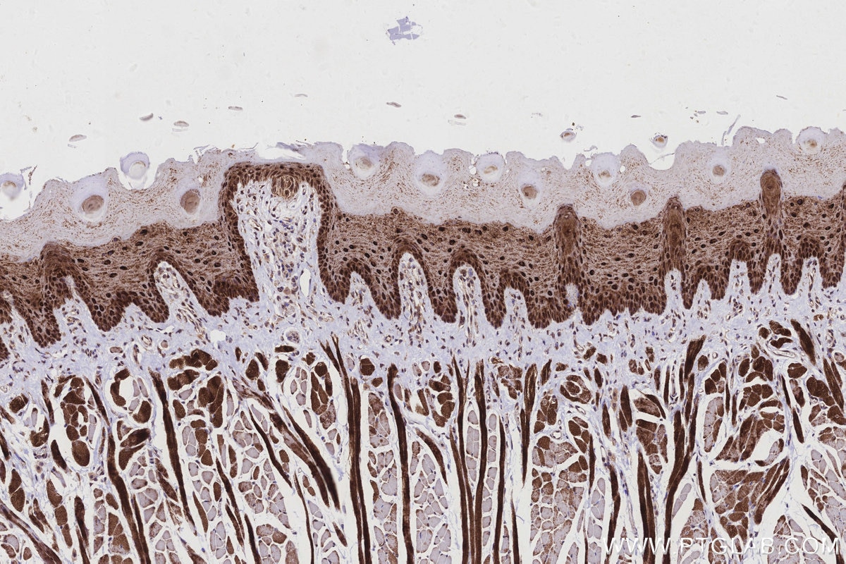 Immunohistochemistry (IHC) staining of rat tongue tissue using MKNK2 Recombinant monoclonal antibody (83235-1-RR)